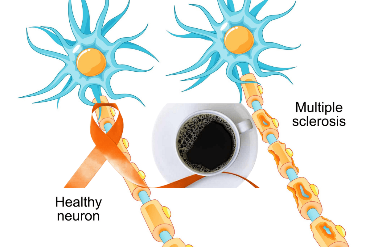 Coffee Consumption Significantly Lowers Risk of Multiple Sclerosis